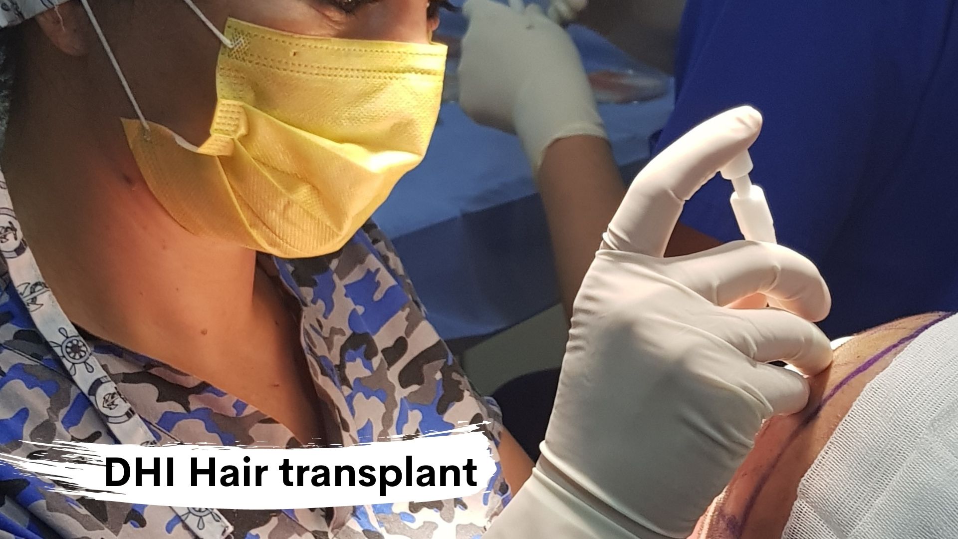 DHI Hair transplant